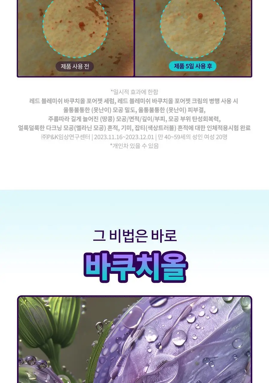 [모공케어/피부결] 닥터지 바쿠치올 포어젯 세럼 30ml 기획 (+포어젯 스피큘 패드 2매 증정) 상세페이지 12